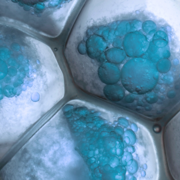 Inflammatory Pathways