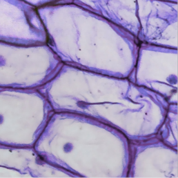 Reducing neuronal oxidative stress